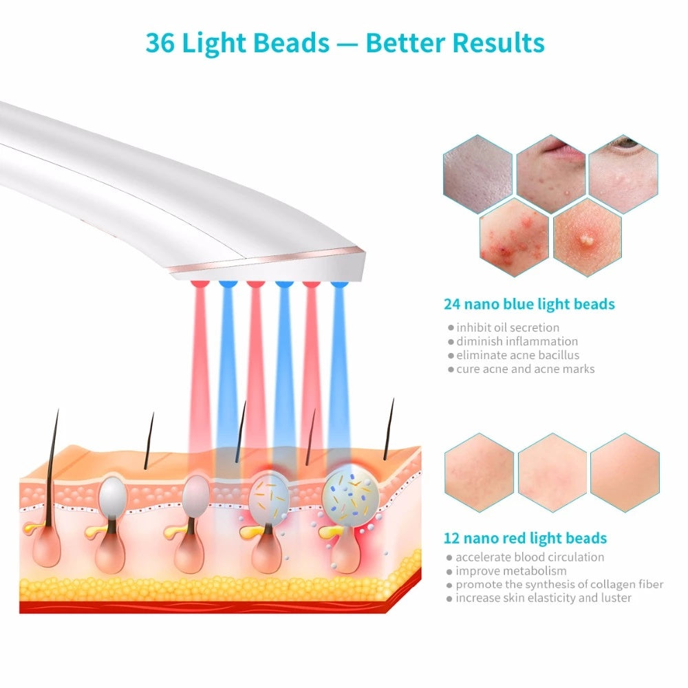 Wireless Acne Light Therapy Device