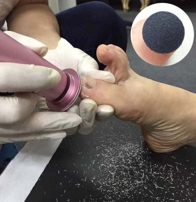 Electric Foot Callus Remover