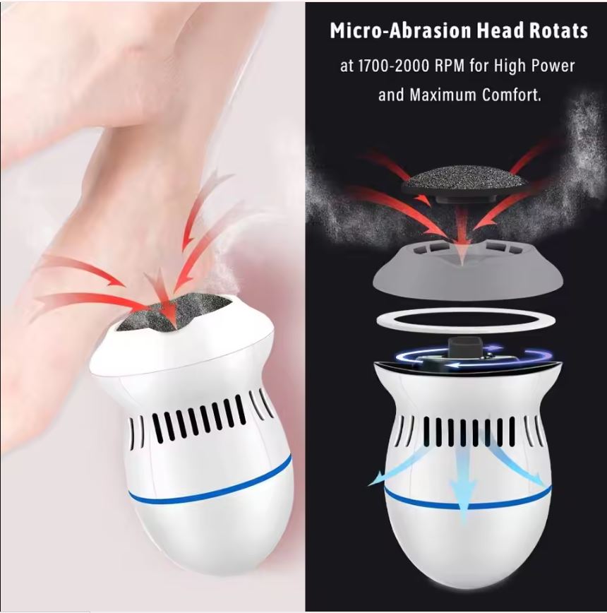 Electric Callus Remover
