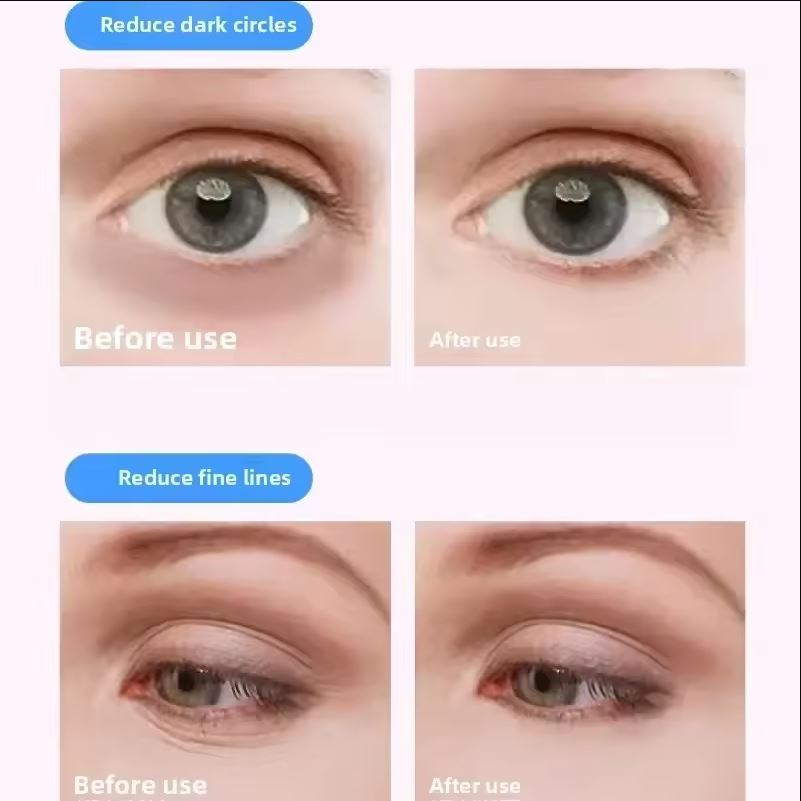 4-in-1 Electric Eye Massager